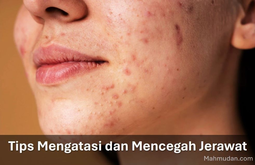 tips mencegah jerawat